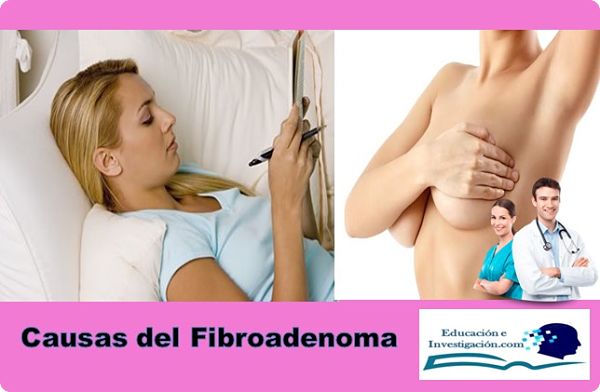 Causas del fibroadenoma