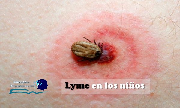Enfermedades más comunes en los bebés, Lyme